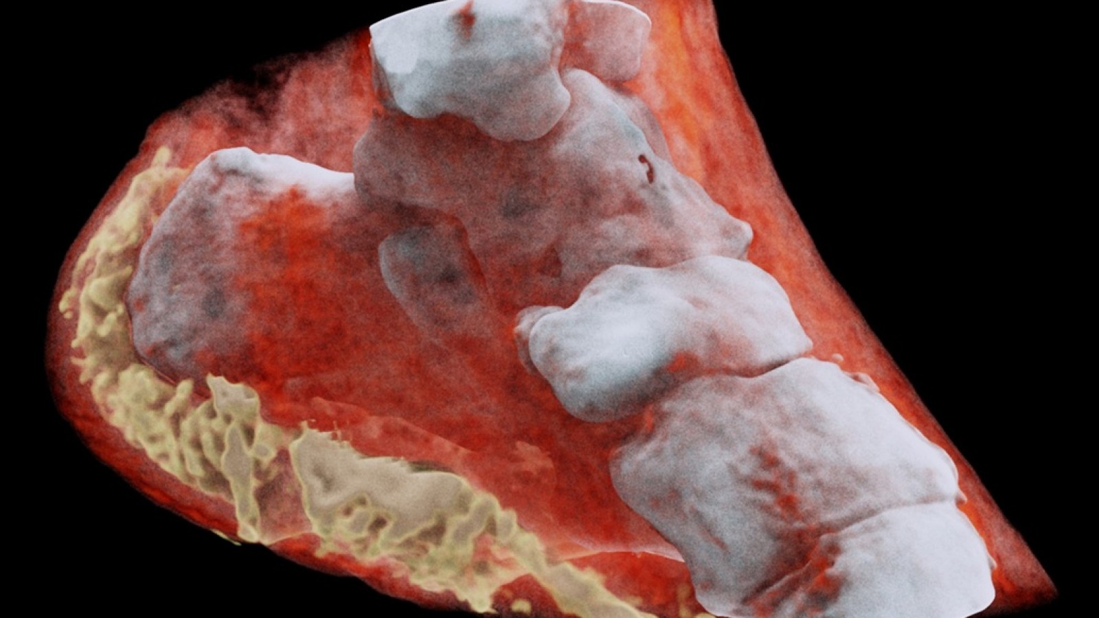 Un grupo de científicos obtiene la primera radiografía a color y en 3D