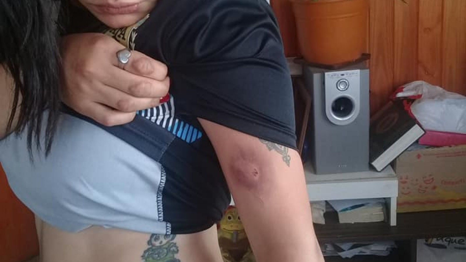 Piedrabuena: Mujer denuncia violencia de género contra su hija por parte de su ex