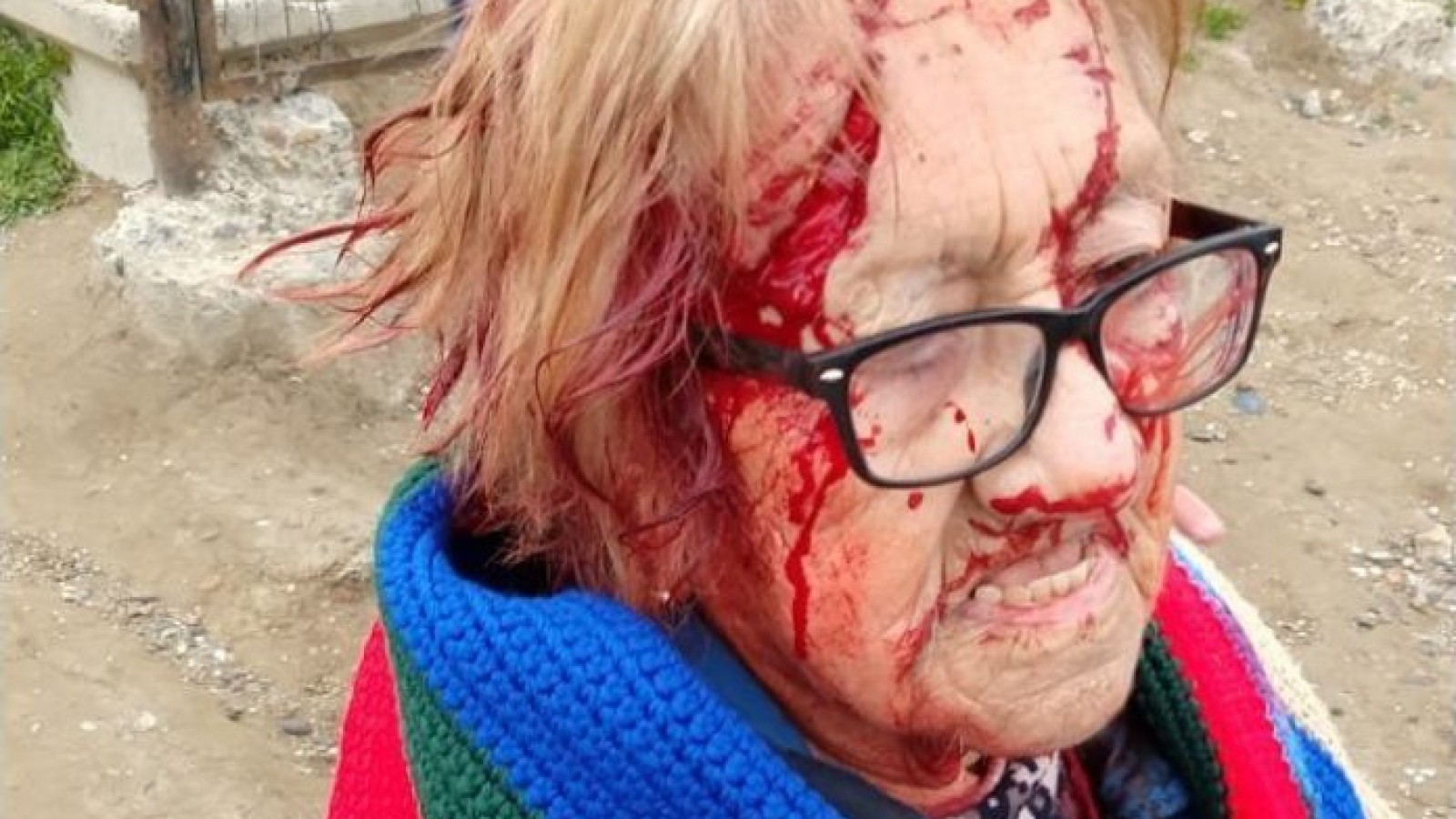 Una abuela fue atacada ferozmente por perros