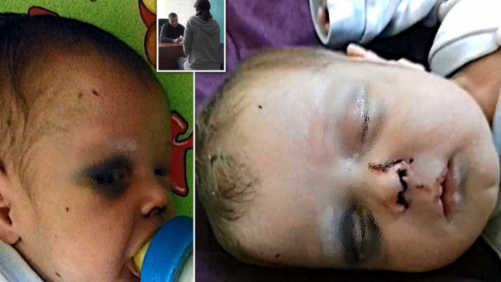 Indigna al mundo el caso del bebé golpeado por su madre para poder ir a una cita con un hombre