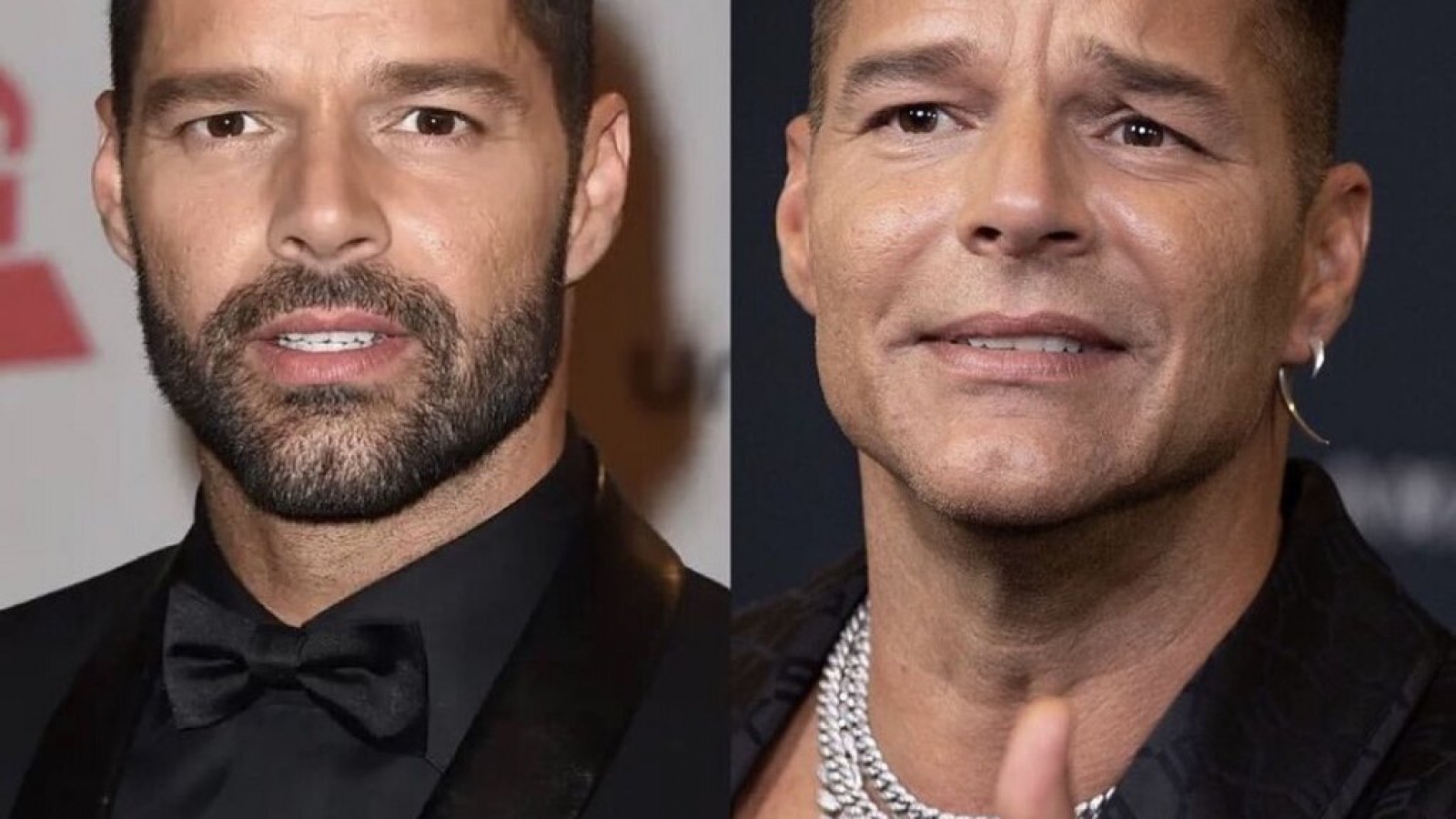 ¿Se retocó la cara? Ricky Martin sorprendió a todos