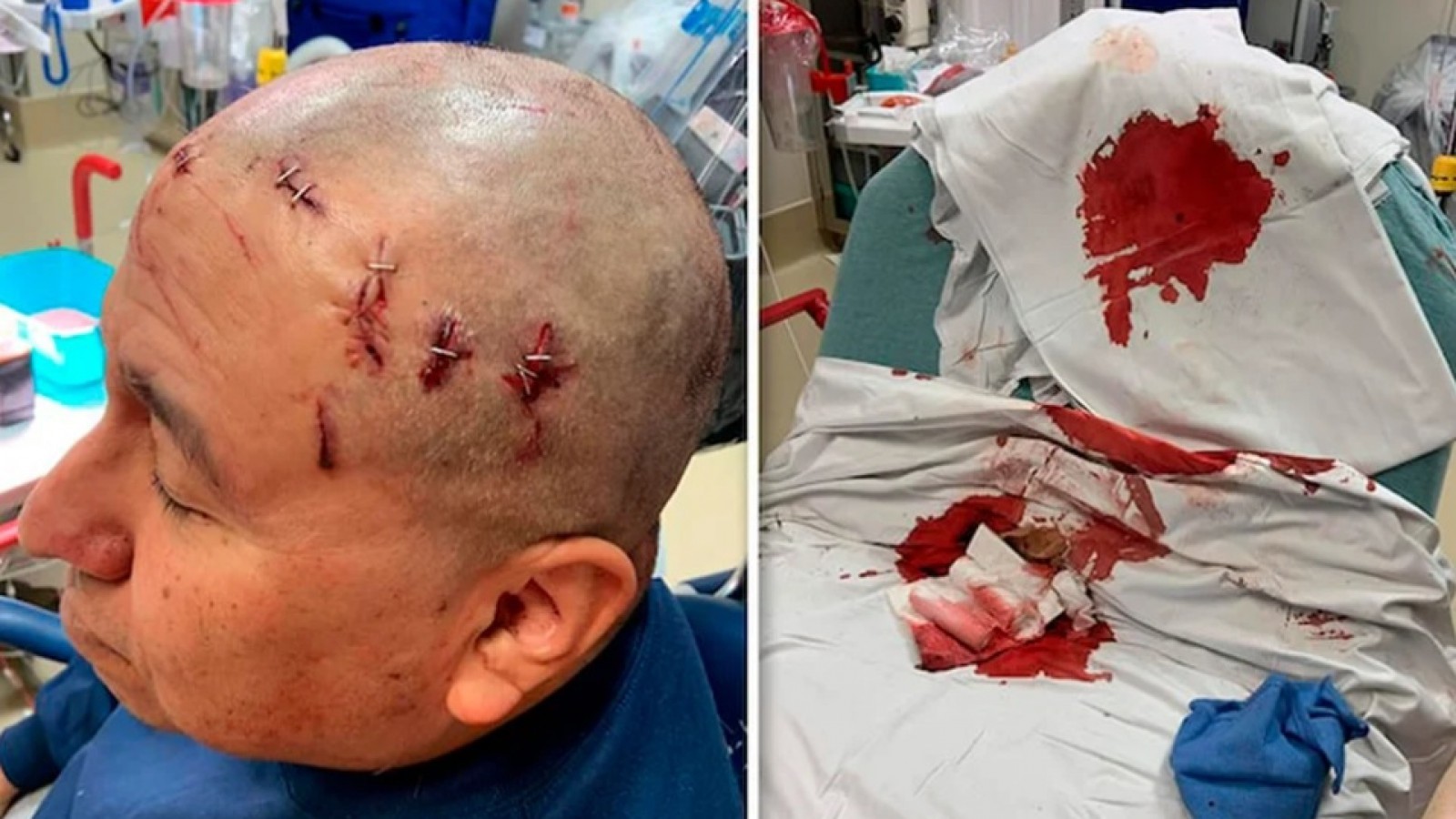 Horror: un árbitro fue apuñalado en la cabeza en la lucha libre