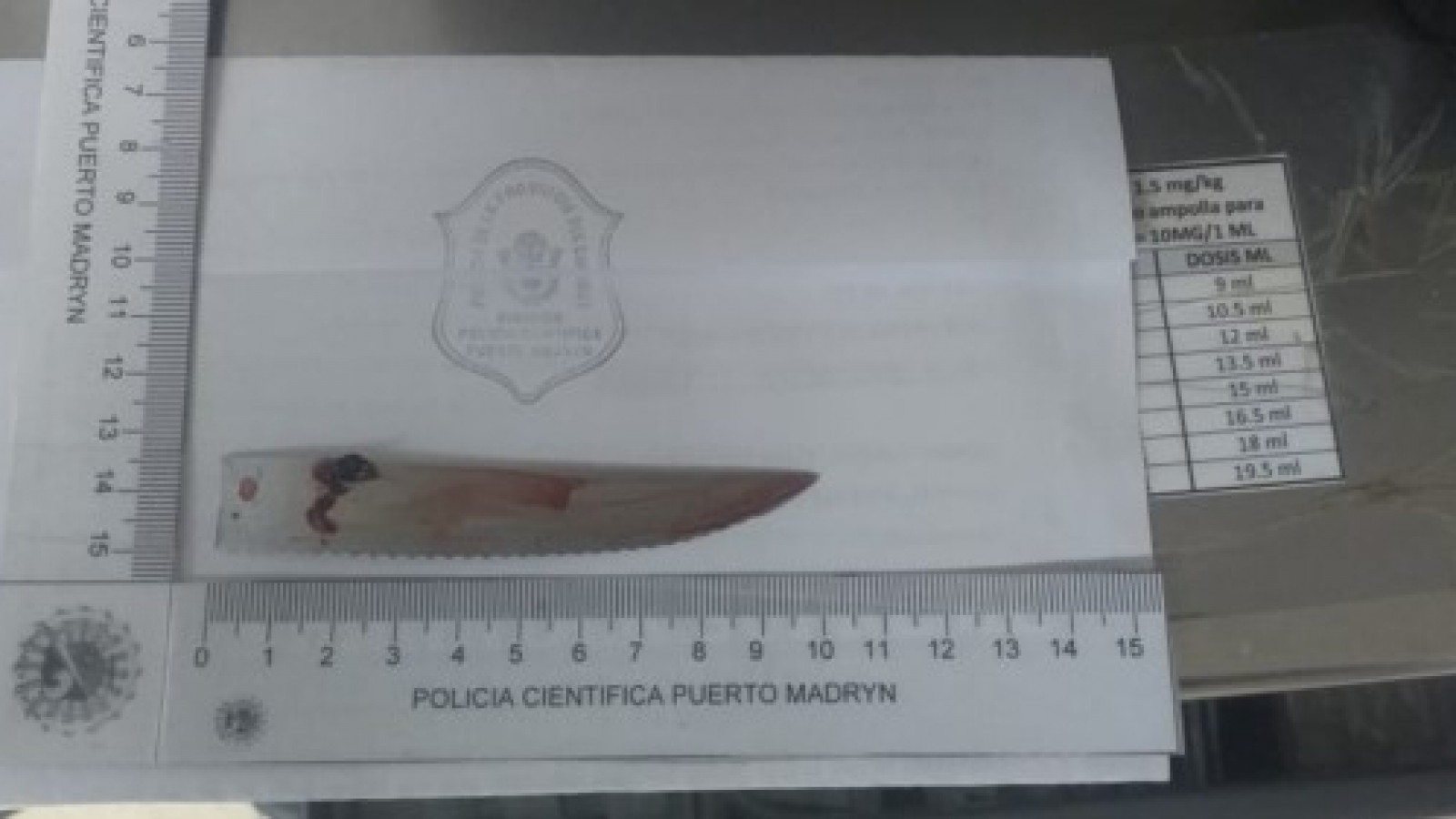 Con un cuchillo clavado en la cabeza persiguió y detuvo a cuatro asaltantes