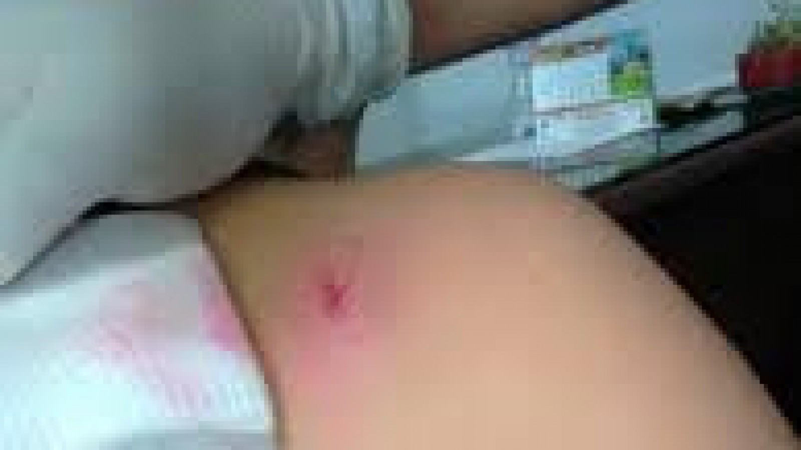 Insólito suceso en Pico Truncado: Tenía un tiro en el hombro y no se había dado cuenta