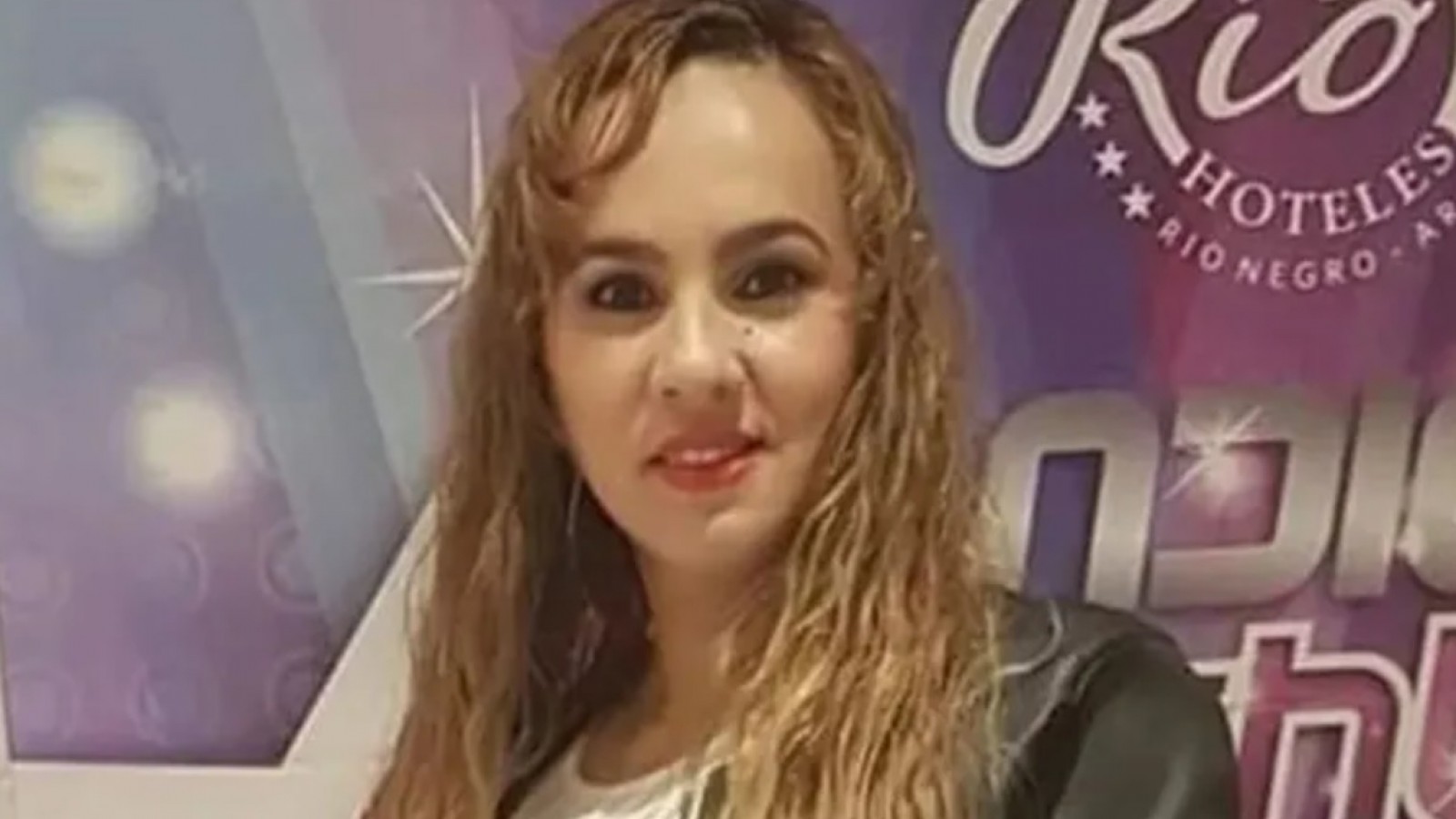 La mujer fue atacada brutalmente