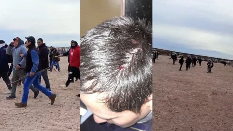 Feroz enfrentamiento de la UOCRA en un yacimiento petrolero de la Patagonia: hubo heridos y detenidos
