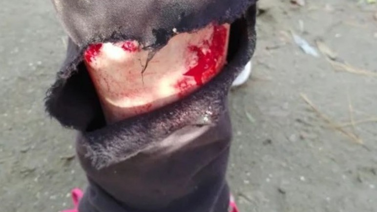 La atacó un perro de atrás y responsabilizó a los dueños porque dejaron el portón abierto