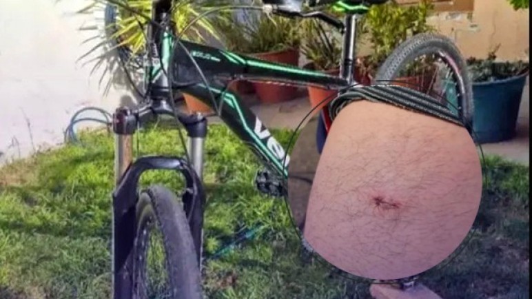 Santa Cruz: apuñalaron a un joven para robarle la bicicleta