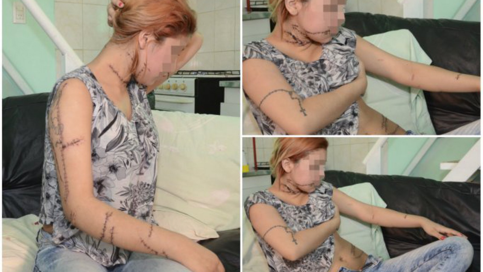 El crudo relato de Laura, la joven cortada con un cúter